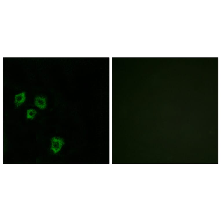 Immunofluorescence - Anti-MUC16 Antibody (C11416) - Antibodies.com