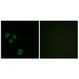 Immunofluorescence - Anti-MUC16 Antibody (C11416) - Antibodies.com