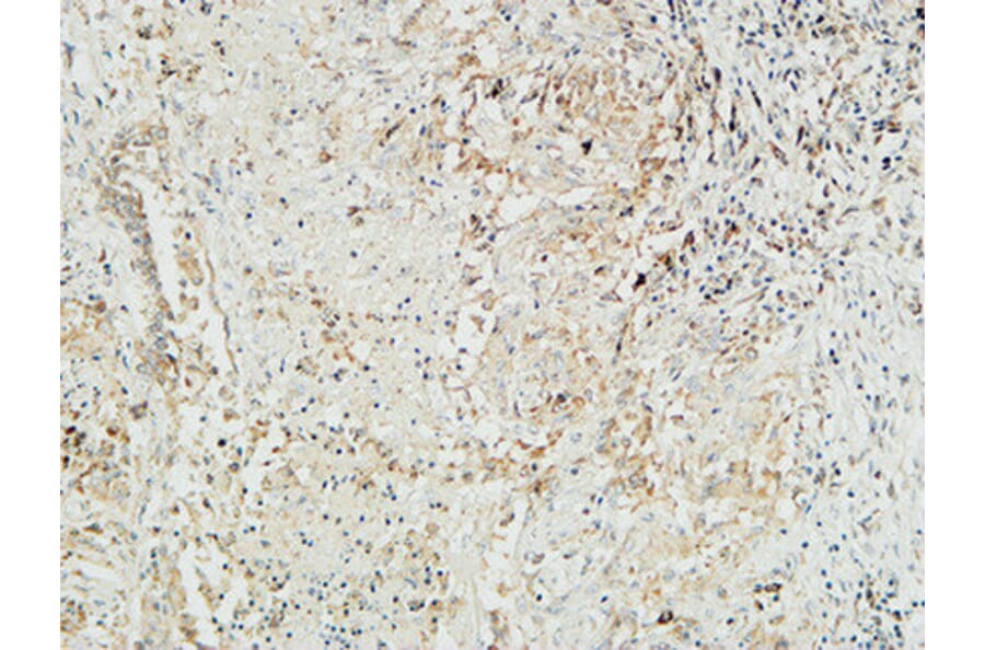 Immunohistochemistry - Anti-MUC16 Antibody (C11416) - Antibodies.com