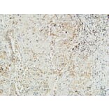 Immunohistochemistry - Anti-MUC16 Antibody (C11416) - Antibodies.com