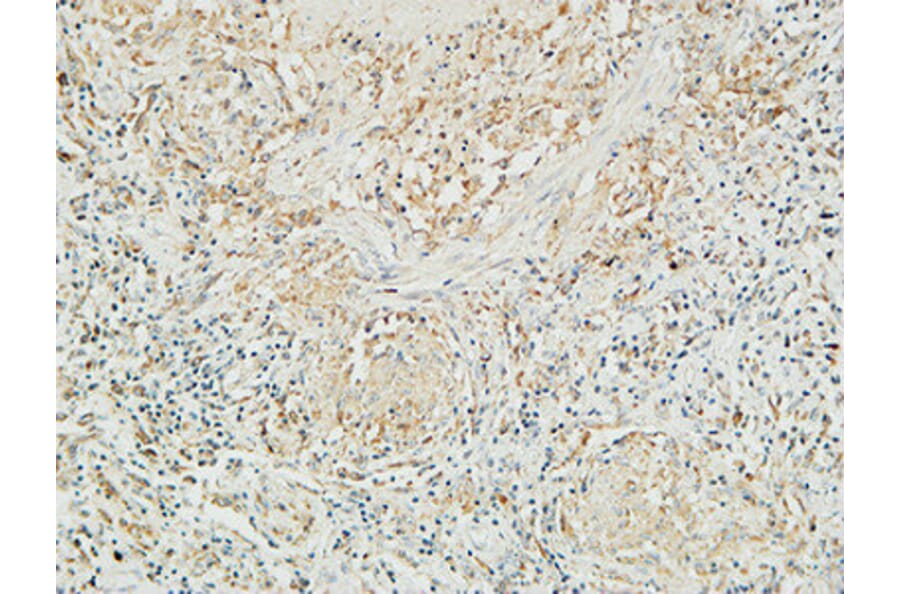 Immunohistochemistry - Anti-MUC16 Antibody (C11416) - Antibodies.com
