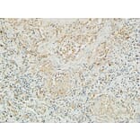 Immunohistochemistry - Anti-MUC16 Antibody (C11416) - Antibodies.com