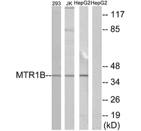 Western Blot - Anti-MTR1B Antibody (G399) - Antibodies.com