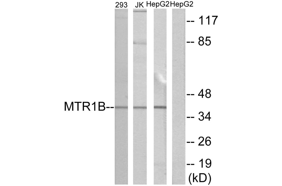Western Blot - Anti-MTR1B Antibody (G399) - Antibodies.com