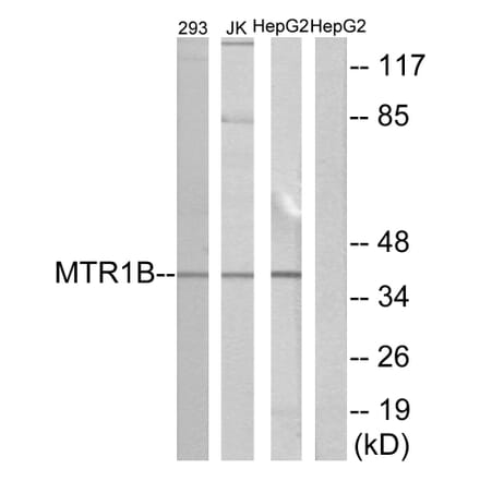 Western Blot - Anti-MTR1B Antibody (G399) - Antibodies.com