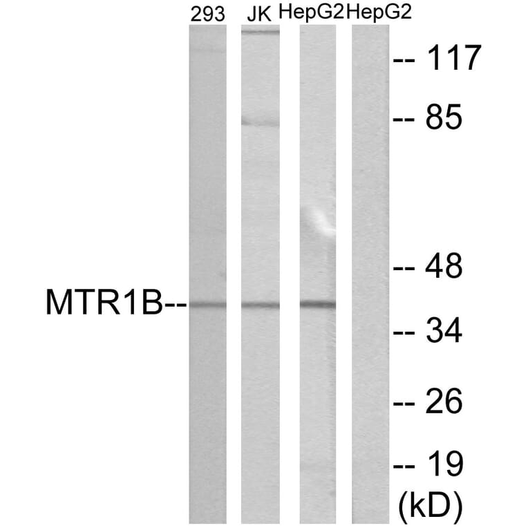 Western Blot - Anti-MTR1B Antibody (G399) - Antibodies.com