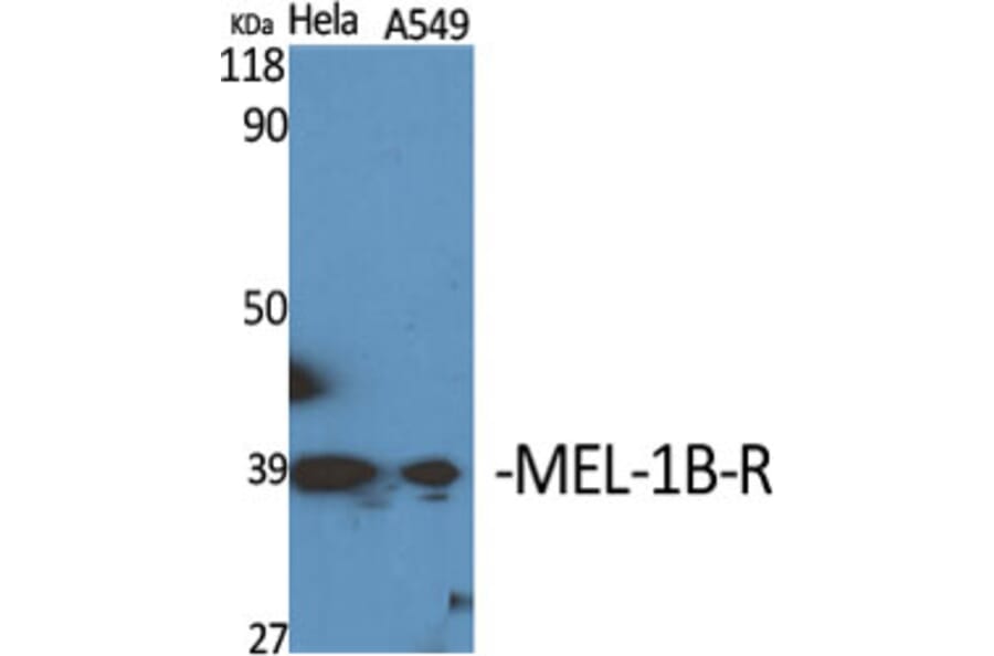 Western Blot - Anti-MTR1B Antibody (G399) - Antibodies.com