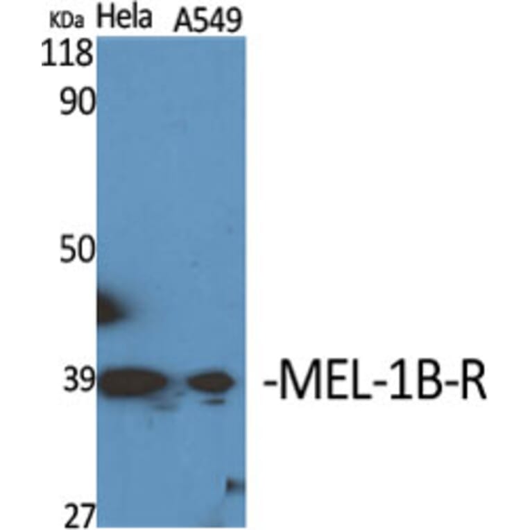 Western Blot - Anti-MTR1B Antibody (G399) - Antibodies.com