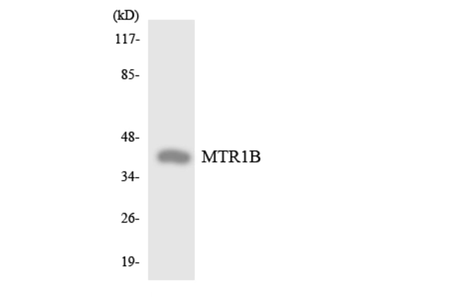 Western Blot - Anti-MTR1B Antibody (R12-3063) - Antibodies.com