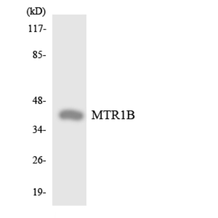 Western Blot - Anti-MTR1B Antibody (R12-3063) - Antibodies.com