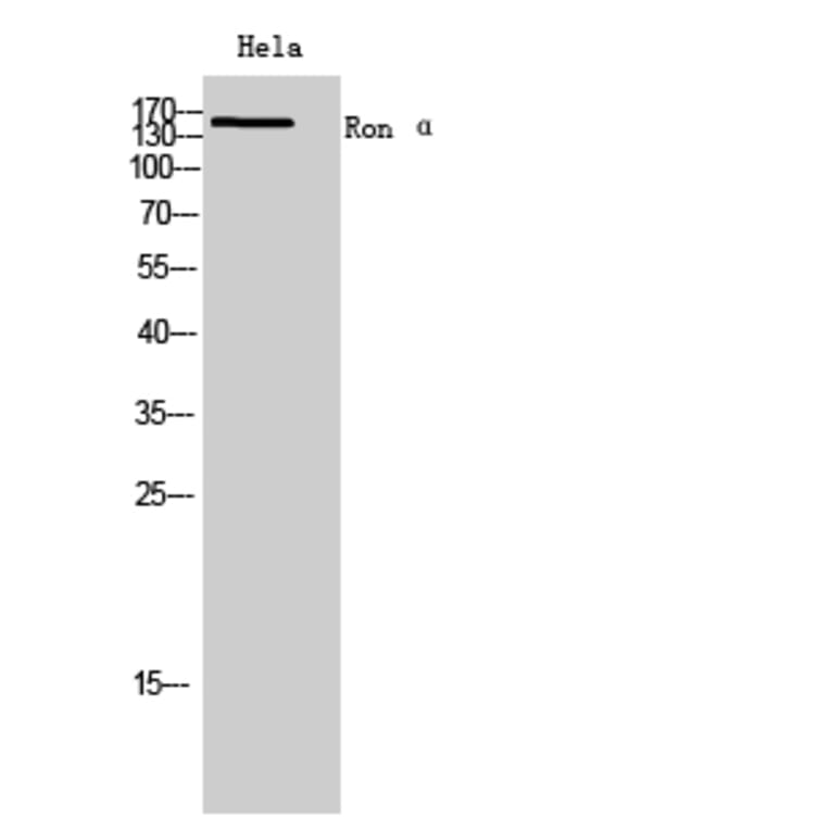 Western Blot - Anti-MST1R Antibody (C30430) - Antibodies.com