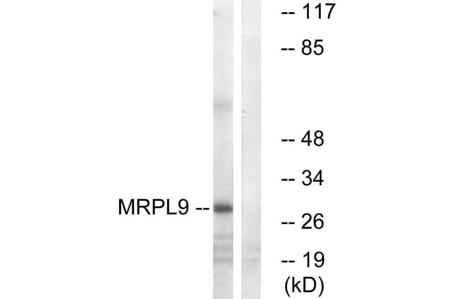 Western Blot - Anti-MRPL9 Antibody (C14089) - Antibodies.com