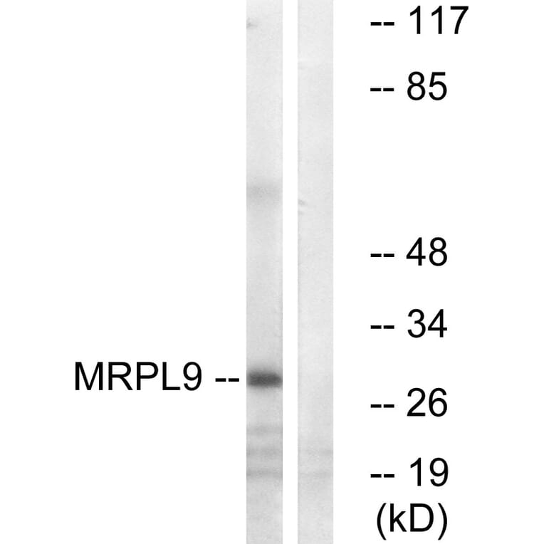 Western Blot - Anti-MRPL9 Antibody (C14089) - Antibodies.com