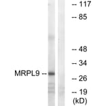 Western Blot - Anti-MRPL9 Antibody (C14089) - Antibodies.com