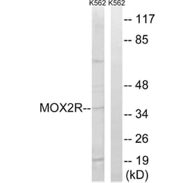 Western Blot - Anti-MOX2R Antibody (C20886) - Antibodies.com