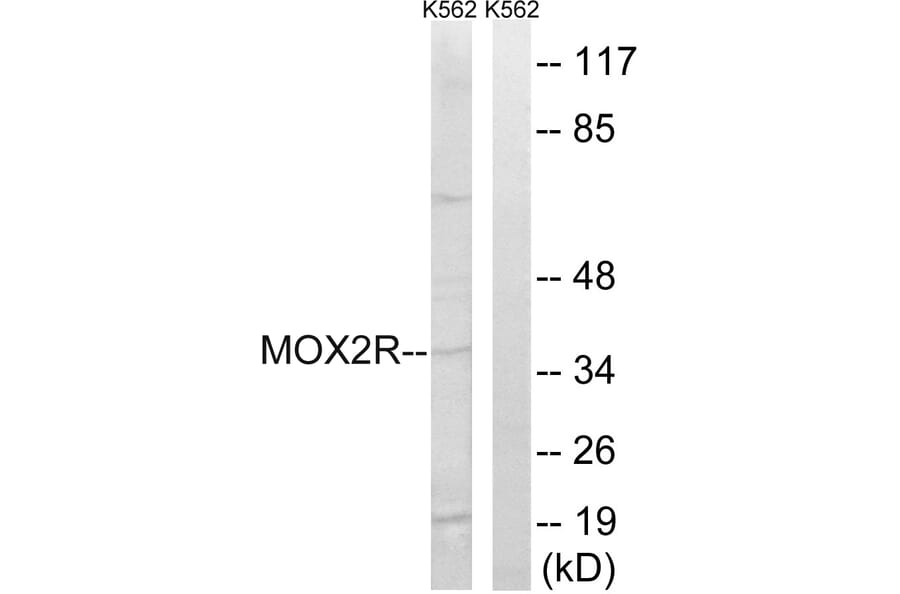 Western Blot - Anti-MOX2R Antibody (C20886) - Antibodies.com