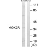 Western Blot - Anti-MOX2R Antibody (C20886) - Antibodies.com