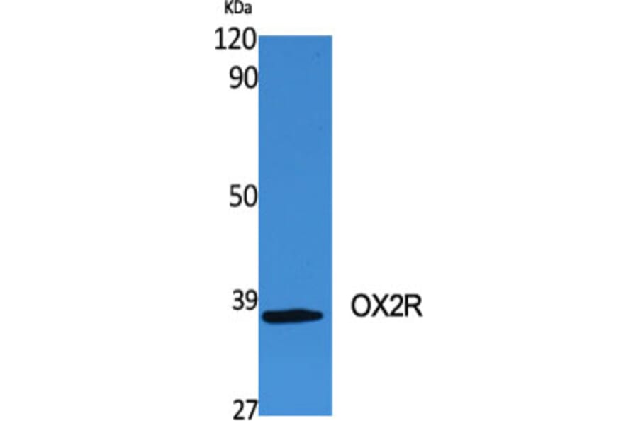 Western Blot - Anti-MOX2R Antibody (C20886) - Antibodies.com