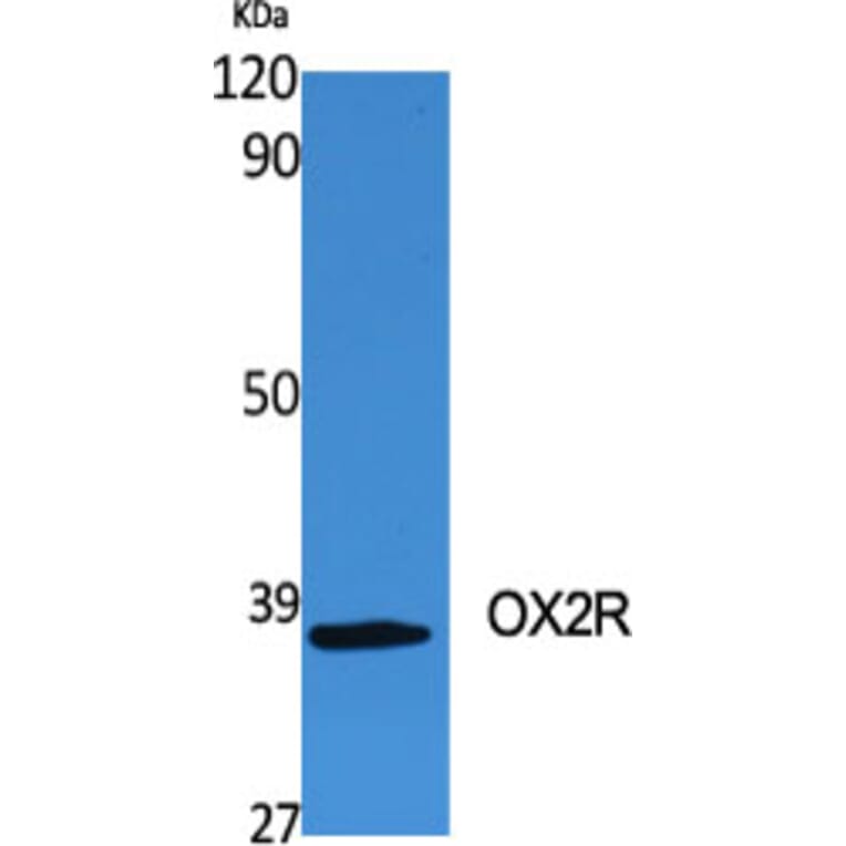 Western Blot - Anti-MOX2R Antibody (C20886) - Antibodies.com