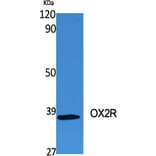 Western Blot - Anti-MOX2R Antibody (C20886) - Antibodies.com