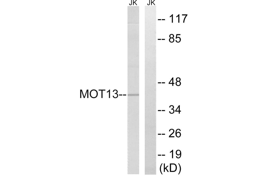 Western Blot - Anti-MOT13 Antibody (C16688) - Antibodies.com