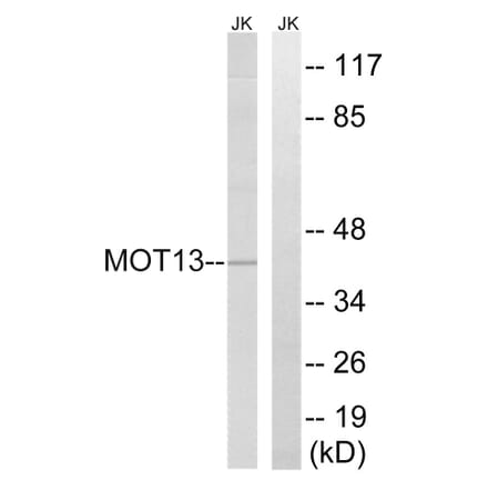 Western Blot - Anti-MOT13 Antibody (C16688) - Antibodies.com