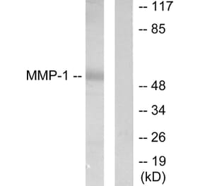 Western Blot - Anti-MMP-1 Antibody (C0262) - Antibodies.com