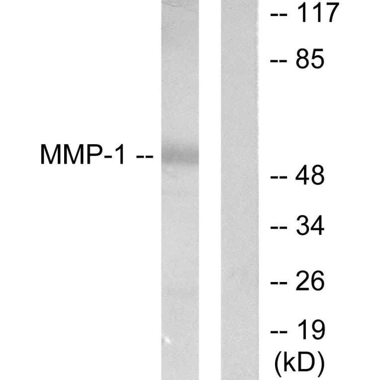 Western Blot - Anti-MMP-1 Antibody (C0262) - Antibodies.com