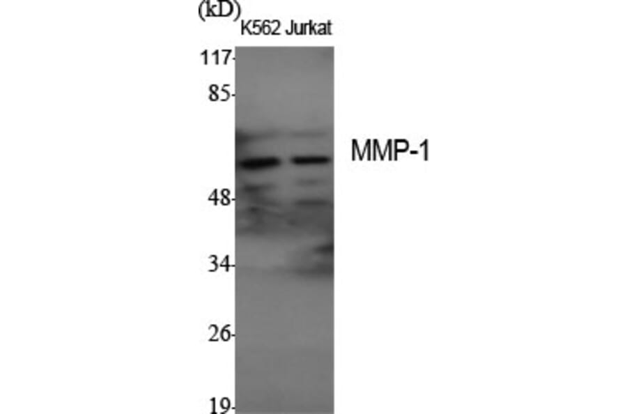 Western Blot - Anti-MMP-1 Antibody (C0262) - Antibodies.com