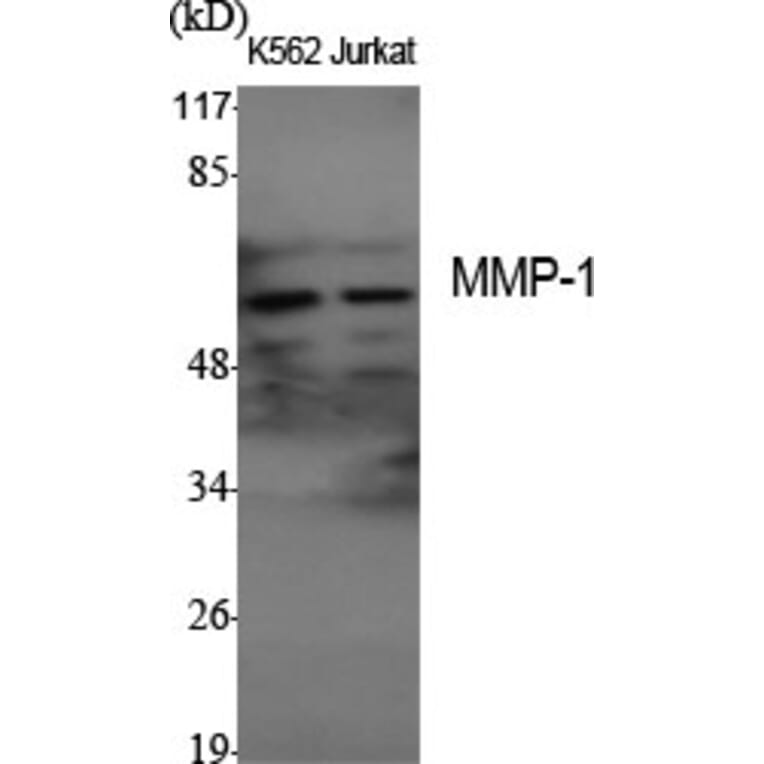 Western Blot - Anti-MMP-1 Antibody (C0262) - Antibodies.com