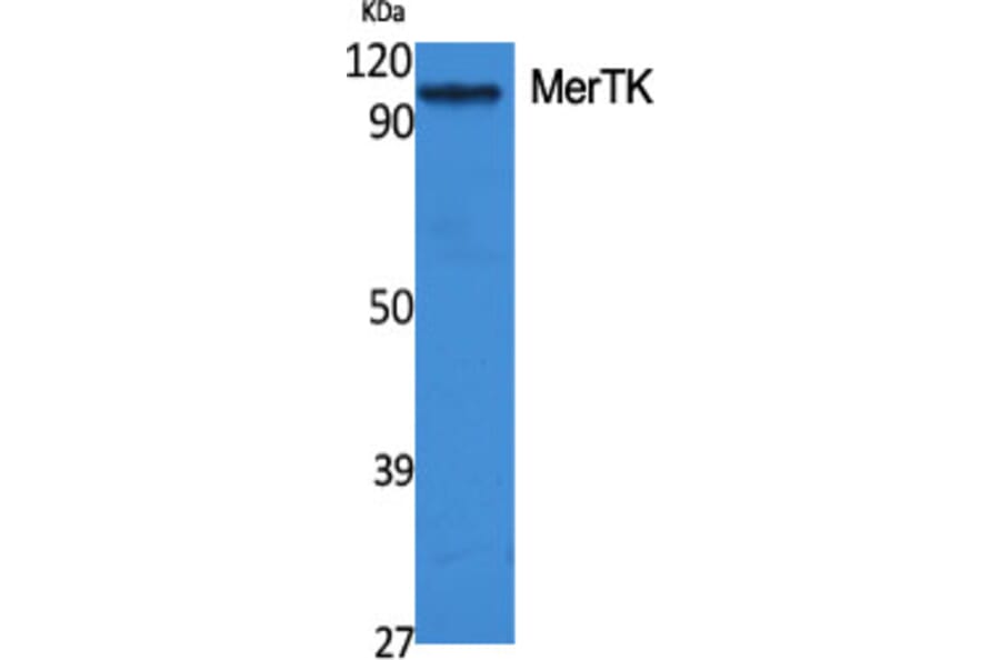 Western Blot - Anti-MERTK Antibody (C21157) - Antibodies.com