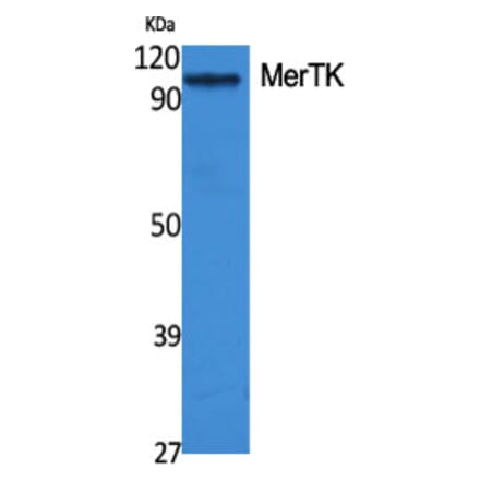 Western Blot - Anti-MERTK Antibody (C21157) - Antibodies.com
