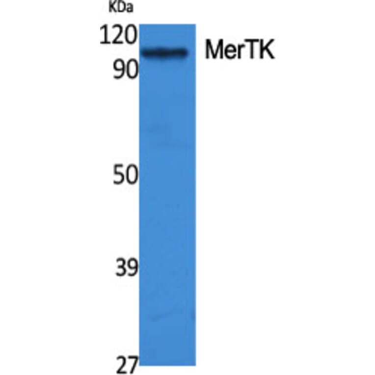 Western Blot - Anti-MERTK Antibody (C21157) - Antibodies.com