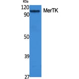 Western Blot - Anti-MERTK Antibody (C21157) - Antibodies.com