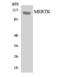 Western Blot - Anti-MERTK Antibody (R12-3015) - Antibodies.com
