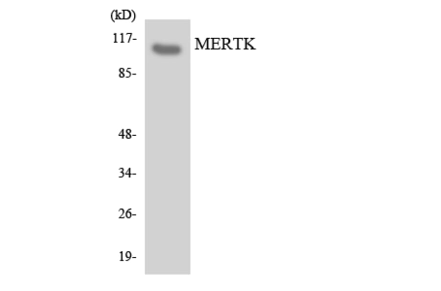 Western Blot - Anti-MERTK Antibody (R12-3015) - Antibodies.com