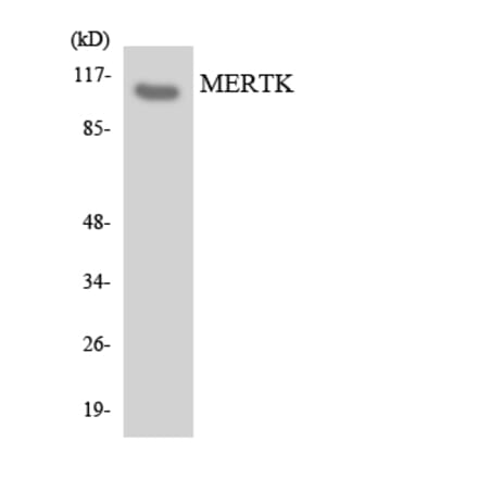 Western Blot - Anti-MERTK Antibody (R12-3015) - Antibodies.com