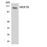 Western Blot - Anti-MERTK Antibody (R12-3015) - Antibodies.com