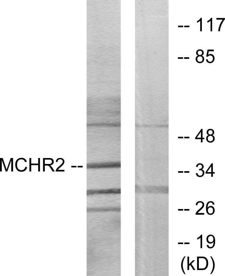Western blot analysis of lysates from HUVEC cells using Anti-MCHR2 Antibody. The right hand lane represents a negative control, where the antibody is blocked by the immunising peptide.
