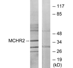 Western Blot - Anti-MCHR2 Antibody (G387) - Antibodies.com