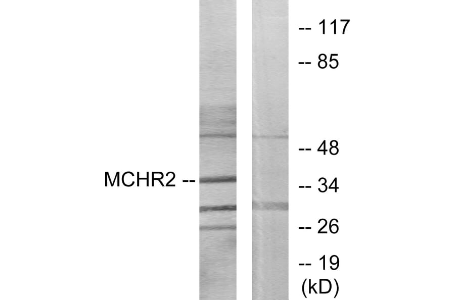 Western Blot - Anti-MCHR2 Antibody (G387) - Antibodies.com