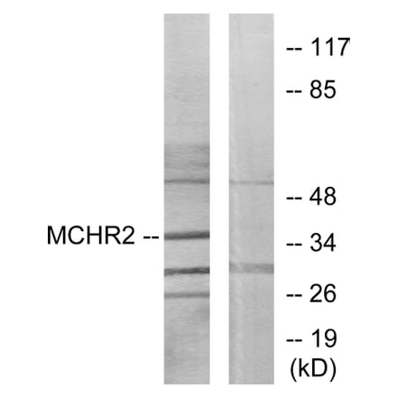 Western Blot - Anti-MCHR2 Antibody (G387) - Antibodies.com