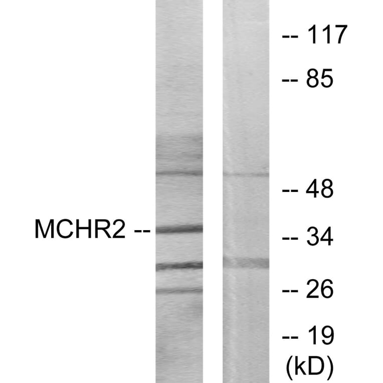 Western Blot - Anti-MCHR2 Antibody (G387) - Antibodies.com