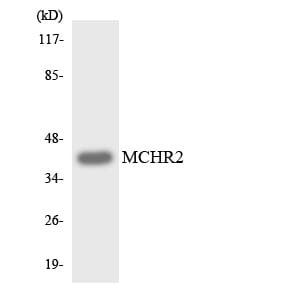 Western blot analysis of the lysates from HeLa cells using Anti-MCHR2 Antibody.