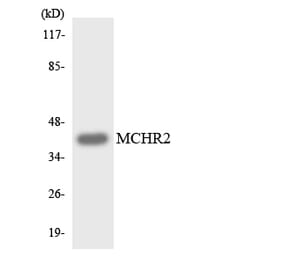 Western Blot - Anti-MCHR2 Antibody (R12-3005) - Antibodies.com