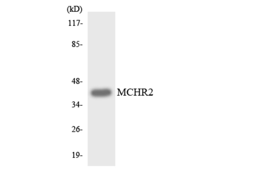 Western Blot - Anti-MCHR2 Antibody (R12-3005) - Antibodies.com