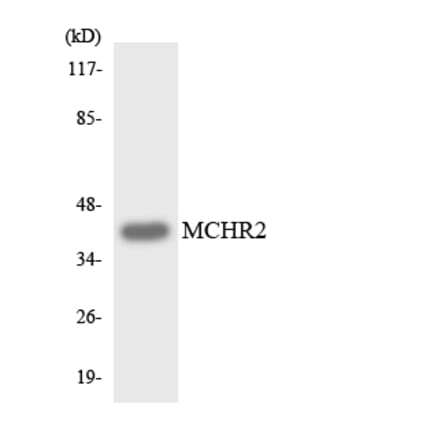 Western Blot - Anti-MCHR2 Antibody (R12-3005) - Antibodies.com