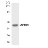 Western Blot - Anti-MCHR2 Antibody (R12-3005) - Antibodies.com