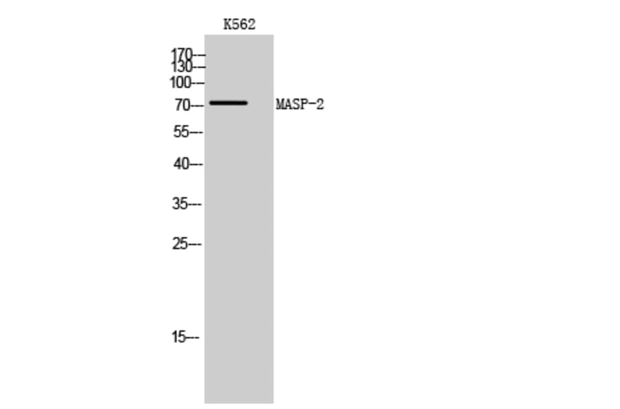 Western Blot - Anti-MASP2 Antibody (C16548) - Antibodies.com