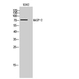 Western Blot - Anti-MASP2 Antibody (C16548) - Antibodies.com